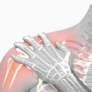 گردن طب سوزنی دکتر سید محدرضا قریشی